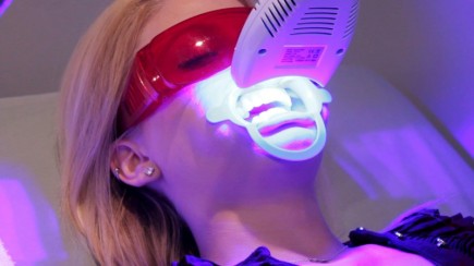 blanqueamiento-dental-laser-e1444131429761